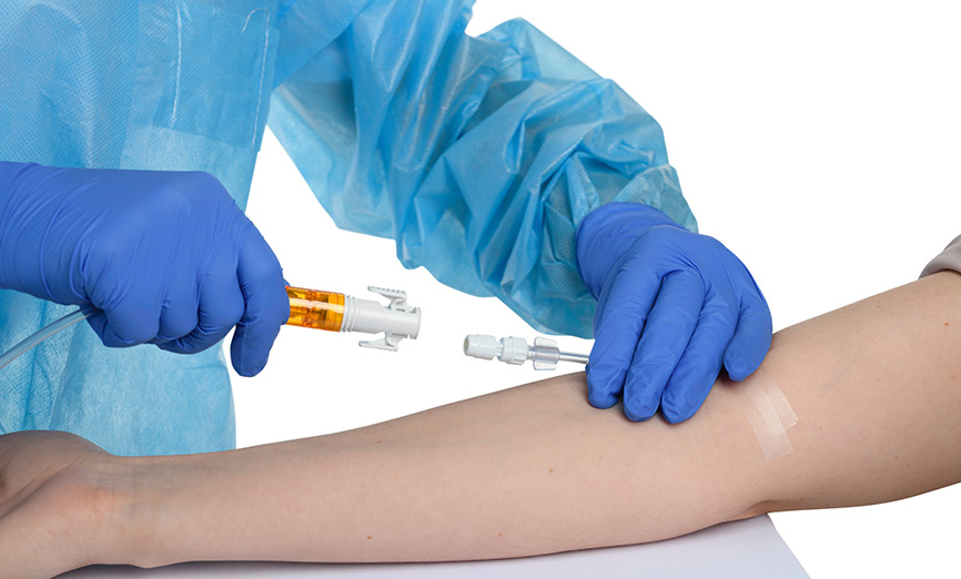 Simplivia Closed System Drug Transfer Device Chemfort Closed Administration CSTD Hazardous Drugs